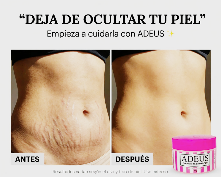 Adeus Crema Brasileña – Crema Rosa Anti-Estrías con Árnica, Jengibre, Cafeína y Té Verde - 300g