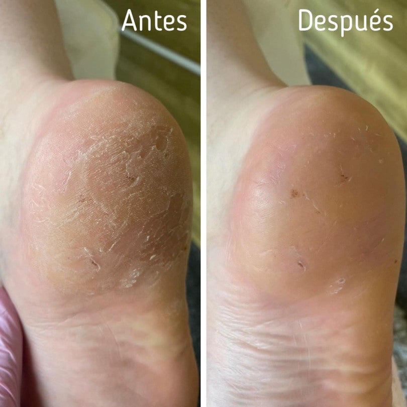 Crema Bálsamo para Talones