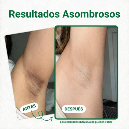 JIYU™ Pads Despigmentantes 100 UNDS ✨ Ayuda a aclarar zonas oscurass