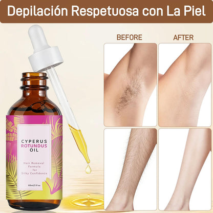 🌸 Cyperus Rotundus Oil - Ayuda a reducir el crecimiento del vello - 60ml