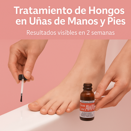 GOTERO ANTIHONGOS GONE AWAY