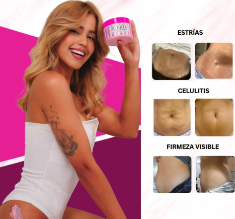 Adeus Crema Brasileña – Crema Rosa Anti-Estrías con Árnica, Jengibre, Cafeína y Té Verde - 300g