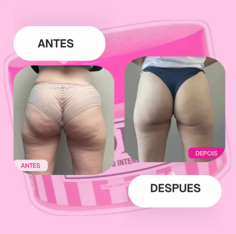 Adeus Crema Brasileña – Crema Rosa Anti-Estrías con Árnica, Jengibre, Cafeína y Té Verde - 300g