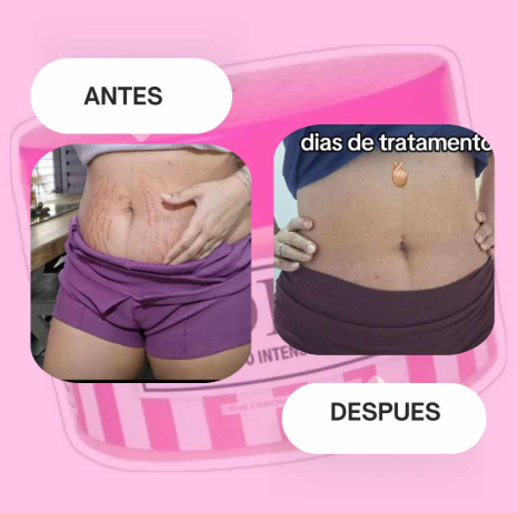 Adeus Crema Brasileña – Crema Rosa Anti-Estrías con Árnica, Jengibre, Cafeína y Té Verde - 300g