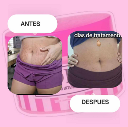 Adeus Crema Brasileña – Crema Rosa Anti-Estrías con Árnica, Jengibre, Cafeína y Té Verde - 300g