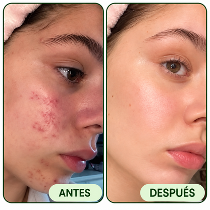 JIYU™ Pads Despigmentantes 100 UNDS ✨ Ayuda a aclarar zonas oscurass